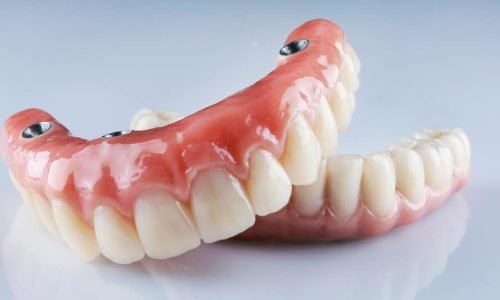 o-que-e-protese-dentaria o-que-e-protese-dentaria